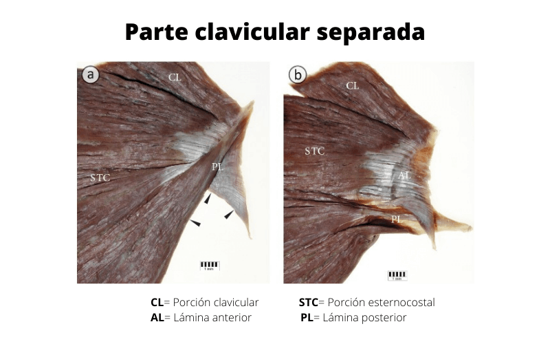 Parte Clavicular A.png